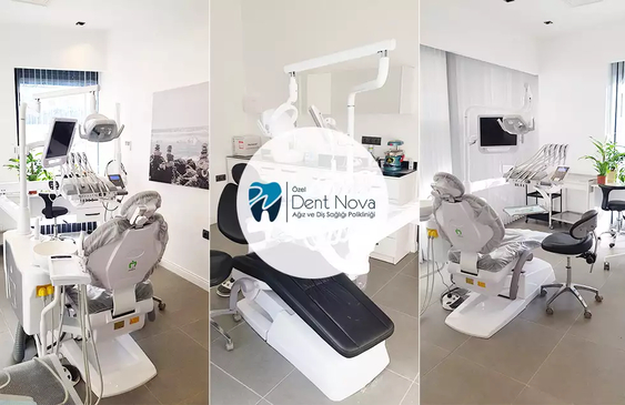 Slider image (3) Dent Nova Dental Clinic